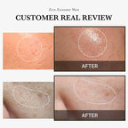 Medicube One Day Exosome Shot 2000 Siero rivitalizzante con microaghi 30 ml - Neko Pop