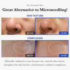 Medicube One Day Exosome Shot 2000 Siero rivitalizzante con microaghi 30 ml - Neko Pop